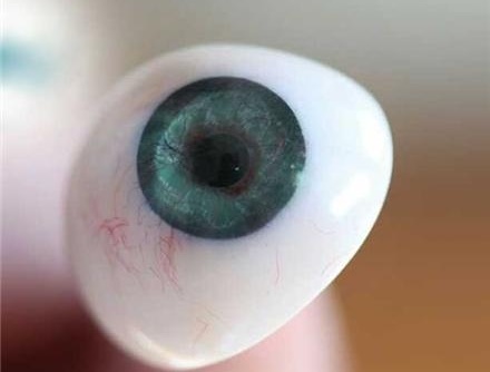 درمان نابینایی با کاشت پروتز چشمی