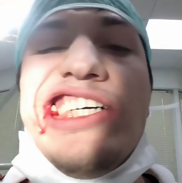 جراحی حرفه ای دندان توسط خود فرد + فیلم