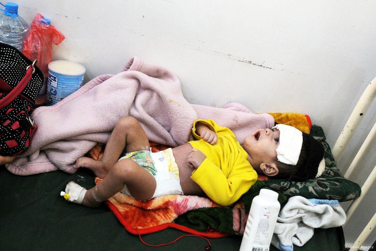 ۲۴.۴ میلیون نفر در یمن به کمک‌های بشر دوستانه نیاز دارند