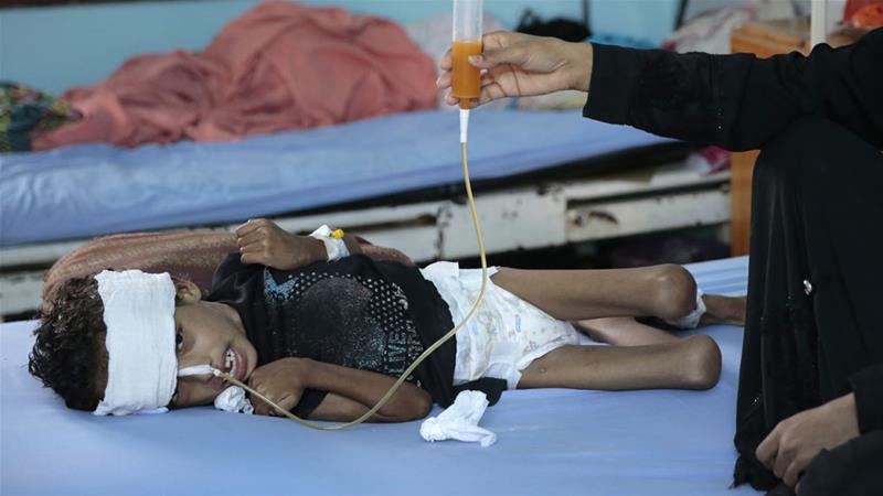 85000 کودک زیر 5 سال در جنگ یمن از گرسنگی جان باخته اند