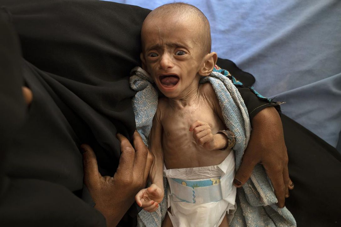 تراژدی جنگ عربستان سعودی در یمن