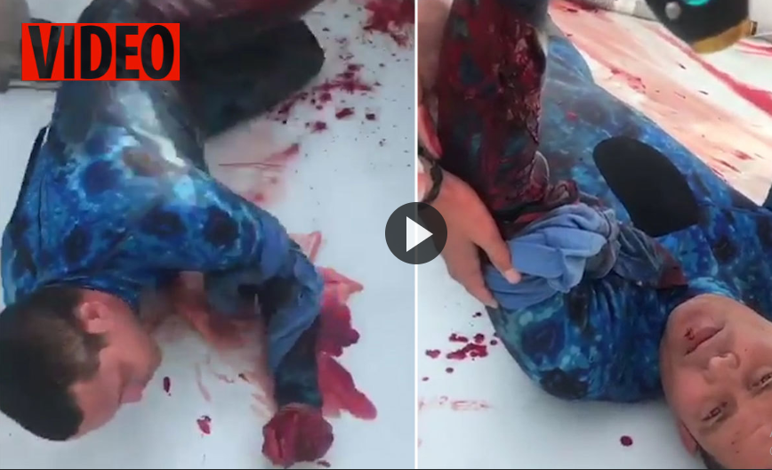 لحظه دلهره آور نجات غواص زخمی پس از حمله مرگبار کوسه +فیلم