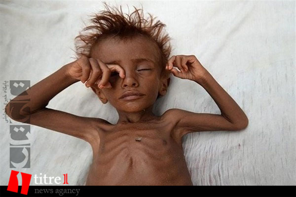 ادامه جنگ، یمن را به فقیرترین کشور جهان تبدیل می کند