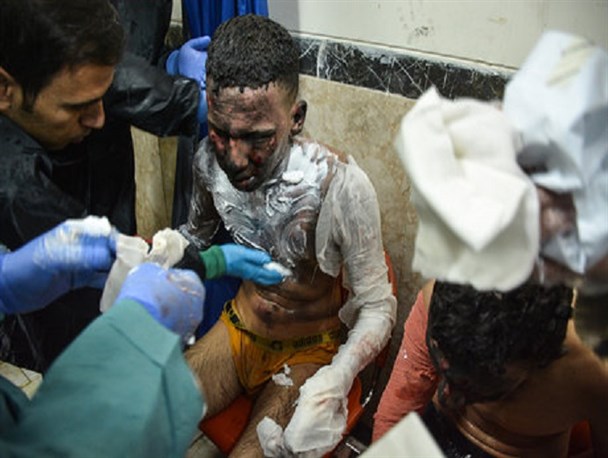 پایان تلخ چهارشنبه سوری در البرز؛ یک خانواده عزادار شدند/ فوت جوان ۱۶ ساله کرجی براثر برخورد مواد محترقه به سر