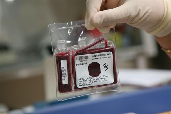 ثبت ۶۶۶ نمونه  فریز شده خون بند ناف در البرز