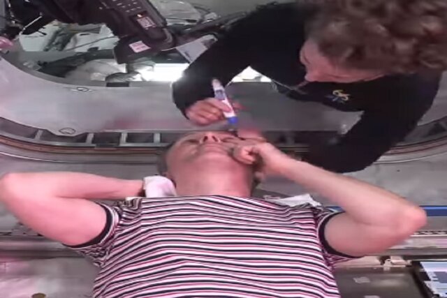 اندازه‌گیری فشار داخل چشم در فضاپیما