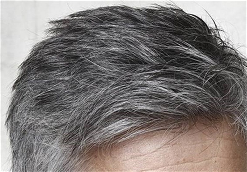 دلایل سفید شدن مو‌ در سنین جوانی و راهکار درمان آن