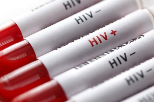 روابط جنسی بیشترین علت بروز HIV در ۱۴۰۱/ چرایی افزایش سهم زنان مبتلا