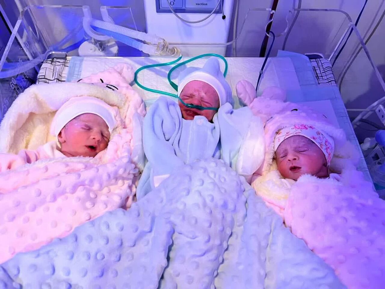 تولد نوزادان سه قلو در کرج