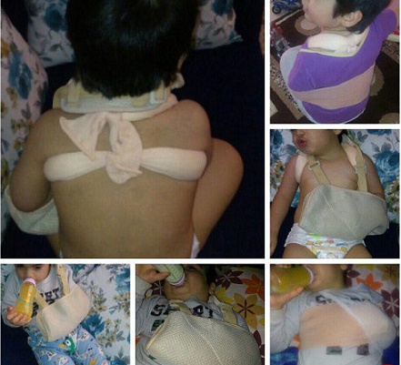 ضرب و شتم کودک سه ساله در یک مهدکودکِ تهران/ تصویر